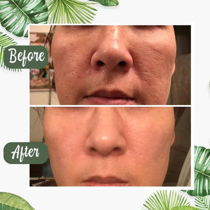 🔥LAST DAY 49% OFF-✨Green Tea Deep Cleanse Mask