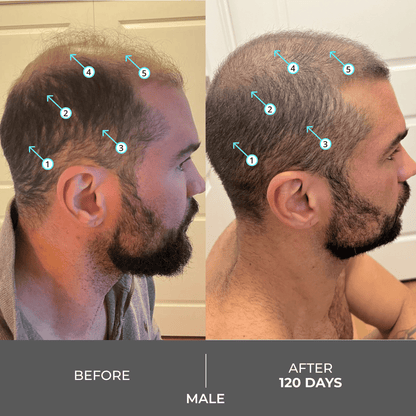 Revita | Extra Strength Hair DENSITY Shampoo