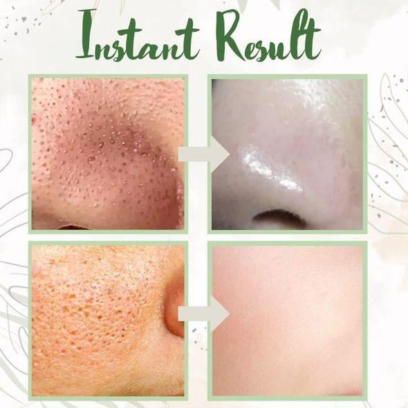 🔥LAST DAY 49% OFF-✨Green Tea Deep Cleanse Mask
