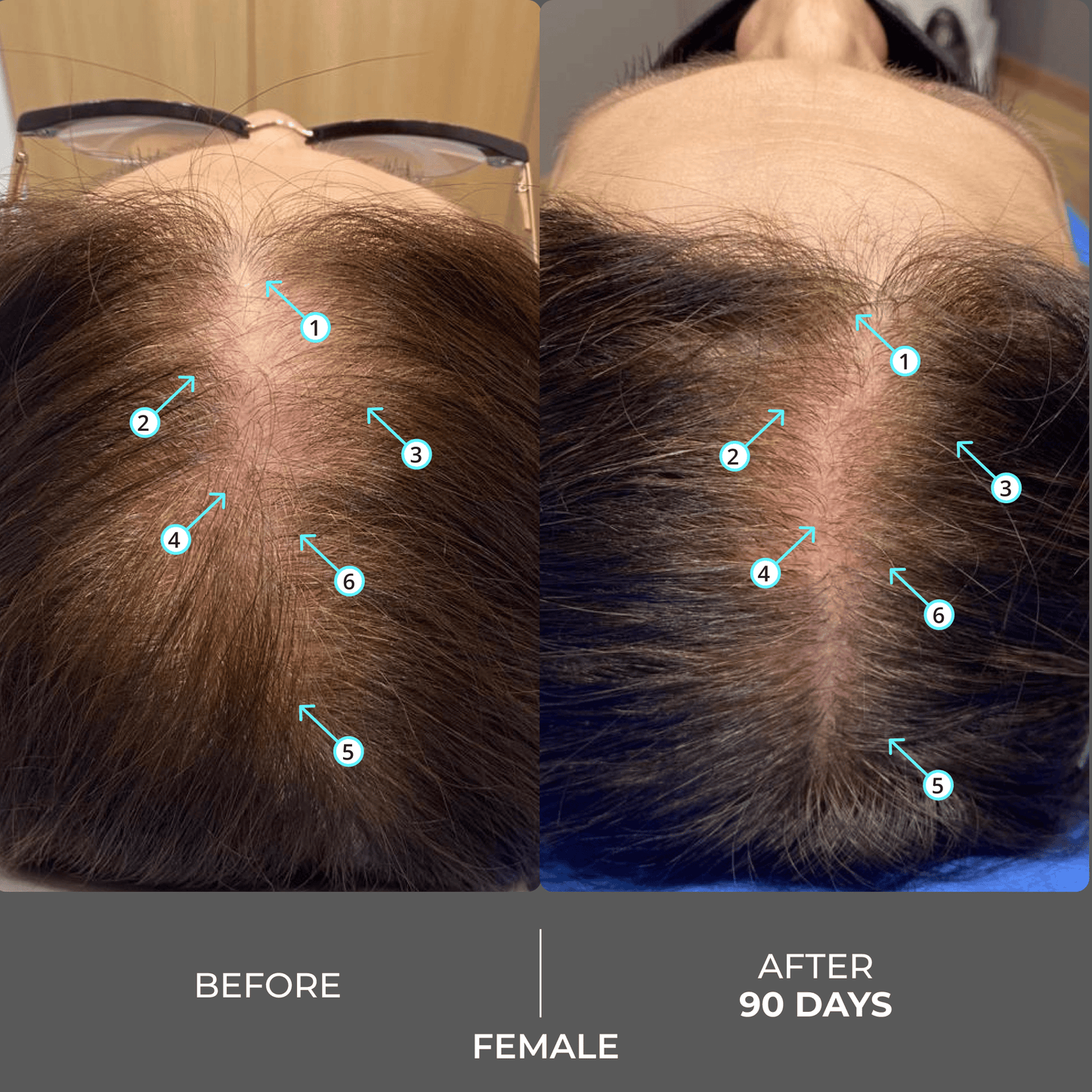 Revita | Extra Strength Hair DENSITY Shampoo