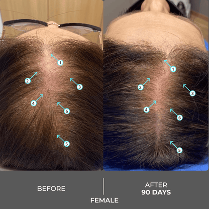 Revita | Extra Strength Hair DENSITY Shampoo