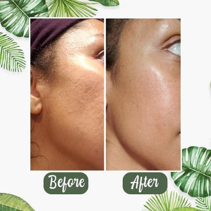 🔥LAST DAY 49% OFF-✨Green Tea Deep Cleanse Mask