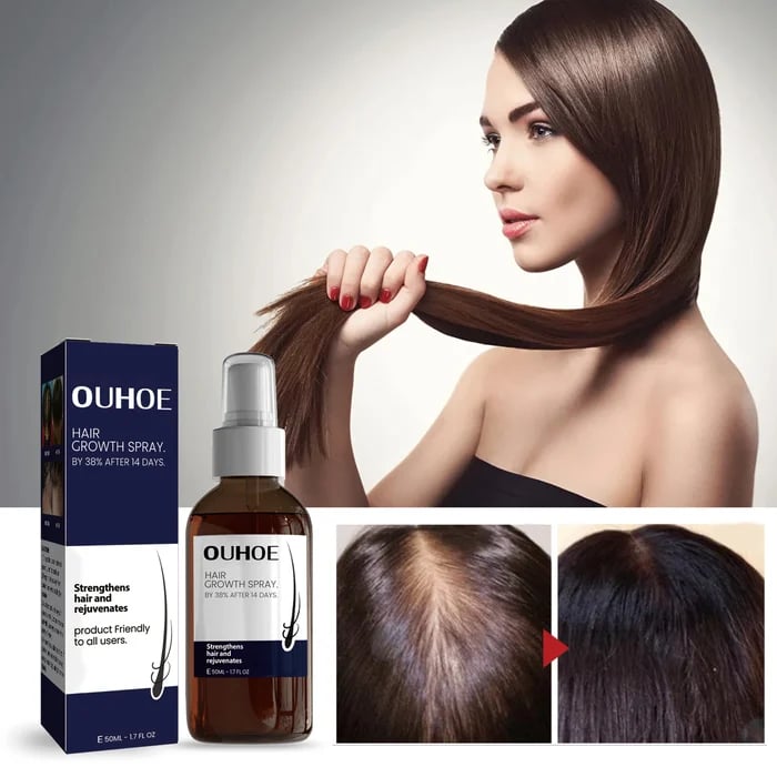 🔥Hot sale 49%OFF🔥Natural Hair Regrowth Spray