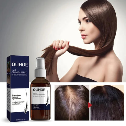 🔥Hot sale 49%OFF🔥Natural Hair Regrowth Spray