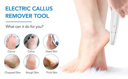 Father's Day  - Electric Feet Callus Remover