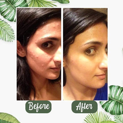 🔥LAST DAY 49% OFF-✨Green Tea Deep Cleanse Mask