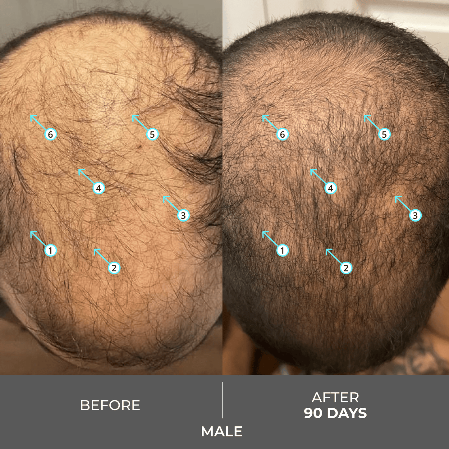 Revita | Extra Strength Hair DENSITY Shampoo