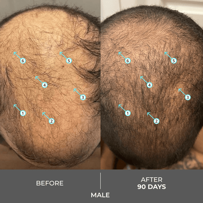 Revita | Extra Strength Hair DENSITY Shampoo