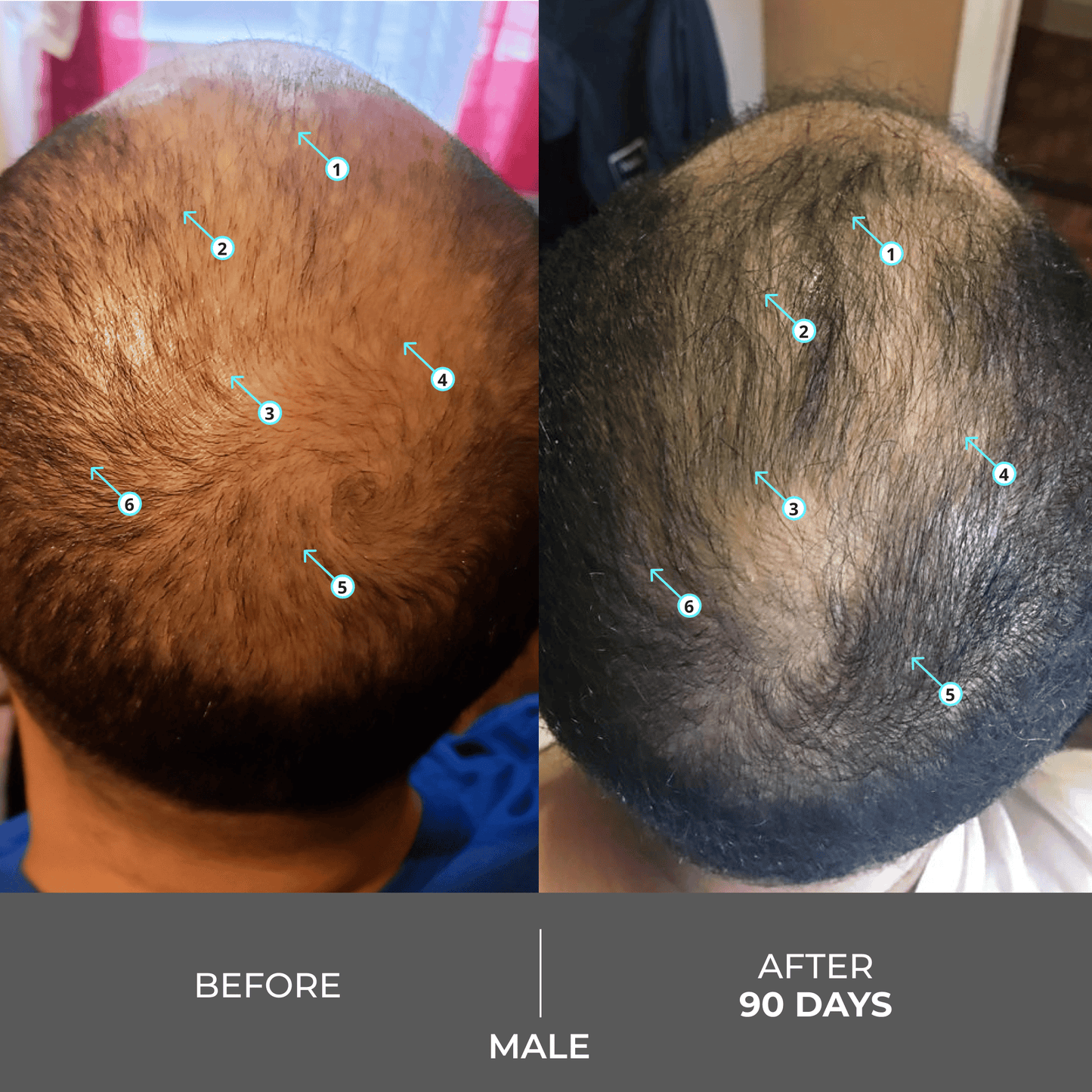 Revita | Extra Strength Hair DENSITY Shampoo